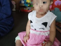 Kondisi Semakin Parah, Seorang Anak 2 Tahun Di Subang Menderita Penyakit Skabies