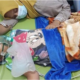 Pemda Subang Berikan Bantuan Kepada Anak Penderita Meningitis